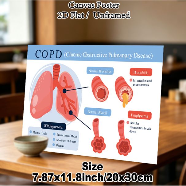 COPD Themed Medical Educational Painting Poster, Clear Informative Illustrative Medical Chart Poster, Visual Guide Explaining COPD Conditions_maomaolike.com