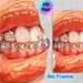 Jeweled Teeth & Glossy Lips Painting Poster, Vibrant Stylized Sparkling Mouth Poster, Eye-catching Decorative Artwork Ideal For Bedroom, Vanity Space_maomaolike.com