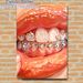 Jeweled Teeth & Glossy Lips Painting Poster, Vibrant Stylized Sparkling Mouth Poster, Eye-catching Decorative Artwork Ideal For Bedroom, Vanity Space_maomaolike.com