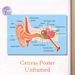 Human Ear Anatomy Painting Poster, Clear Scientific Illustrated Poster, Detailed Labeled Ear Structure Diagram, Practical Educational Decor For_maomaolike.com