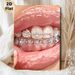 Glittery Teeth & Lips Painting Poster, Shiny Glamorous Stylized Art Poster, Eye-catching Sparkling Diamond-adorned Dental Design, Suitable For Bedroom_maomaolike.com