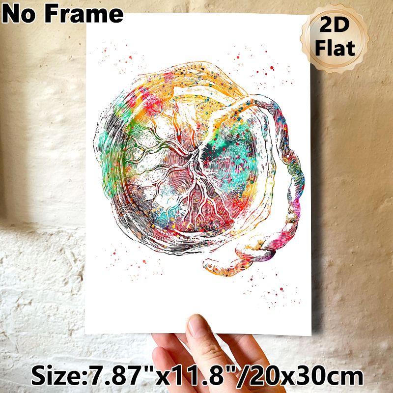 Placenta Anatomy Painting Poster, Vibrant Watercolor Detailed Anatomical Art Poster, Unique Medical-themed Decor Suitable For Clinic, Office And Home_maomaolike.com