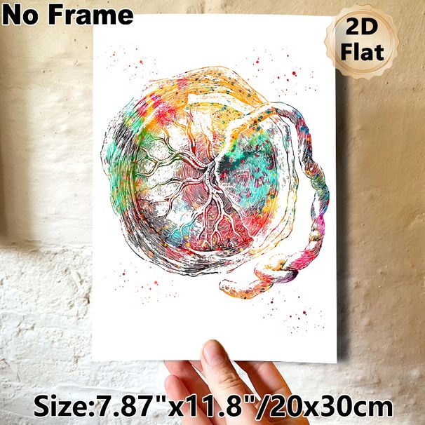 Placenta Anatomy Painting Poster, Vibrant Watercolor Detailed Anatomical Art Poster, Unique Medical-themed Decor Suitable For Clinic, Office And Home_maomaolike.com