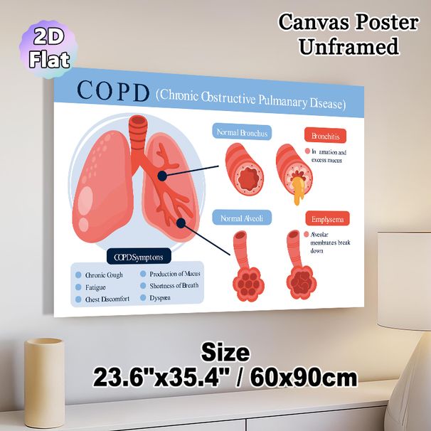COPD Themed Medical Educational Painting Poster, Clear Informative Illustrative Medical Chart Poster, Visual Guide Explaining COPD Conditions_maomaolike.com